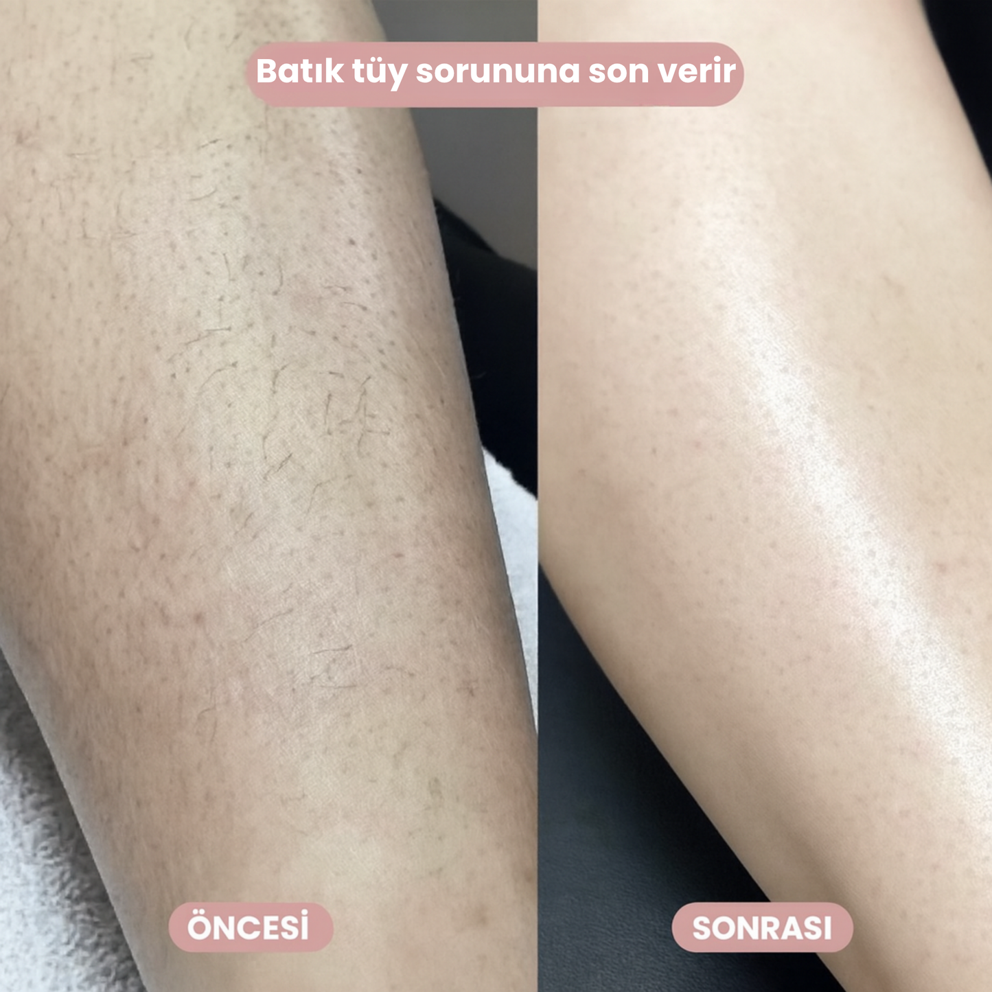 Puraura –  2’si 1 Arada Vücut Tıraş Cihazı