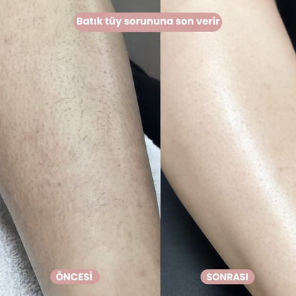 Puraura –  2’si 1 Arada Vücut Tıraş Cihazı