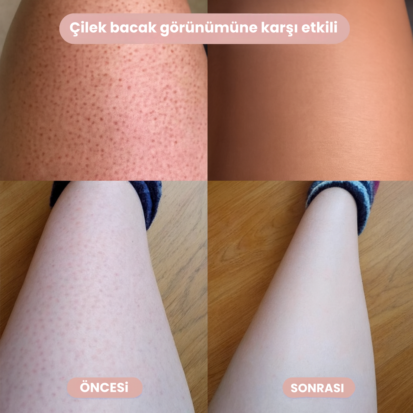 Puraura –  2’si 1 Arada Vücut Tıraş Cihazı